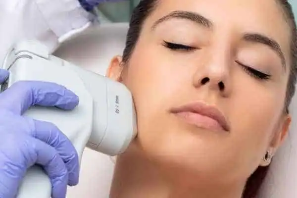 Image of woman having HIFU Weymouth treatment