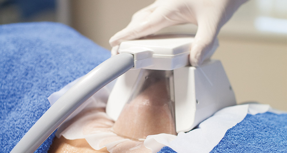 How Fat Freezing and HIFU Work Together? 2 Multiple Areas in One Session HIFU and Fat Freezing Weymouth