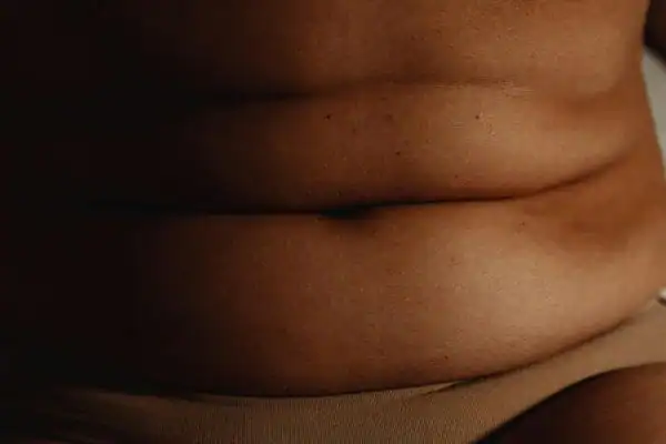 The Hidden Connection: How Stress Shapes Your Fitness and Body Composition 3 image of what stress can do on the stomach area and how Lipo 360 Weymouth can help to change your body shape.
